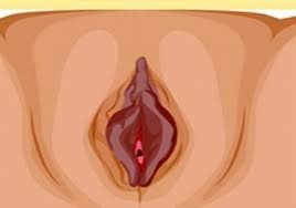 hình ảnh cô bé bị thâm đen